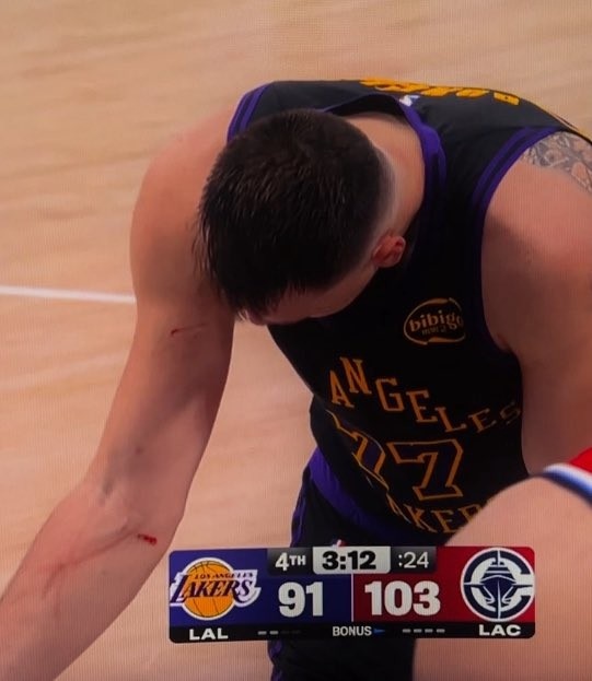 谁抓的~东契奇罚球时看向手臂 好几道伤口&血迹斑斑